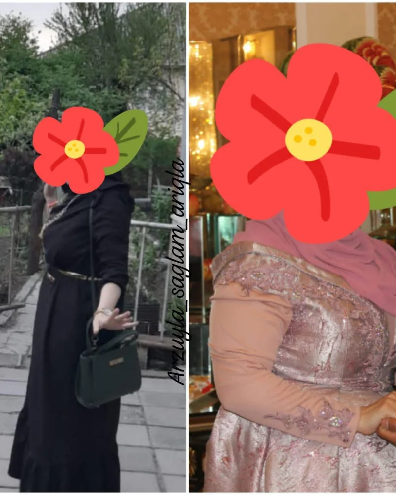 Qalereya şəkil 7