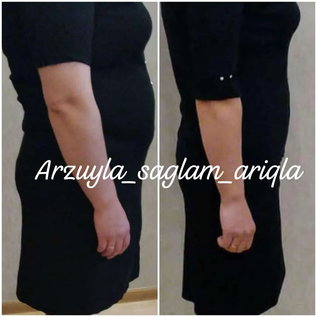 Qalereya şəkil 9