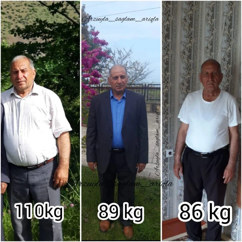 Qalereya şəkil 10