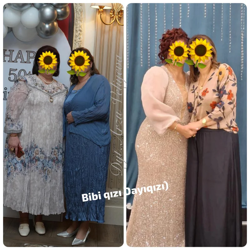 Qalereya şəkil 12