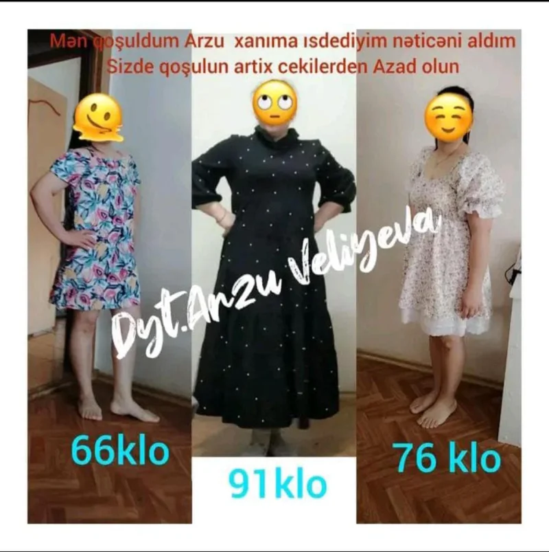 Qalereya şəkil 14