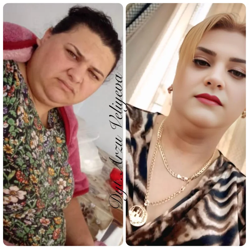 Qalereya şəkil 29